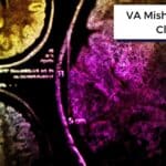 va mishandles tbi claims title on brain mri scan