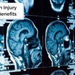 acute brain injury disability benefits on brain mri